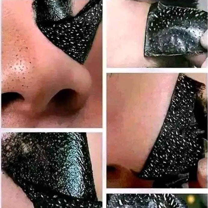 Mascarilla peel-off para puntos negros